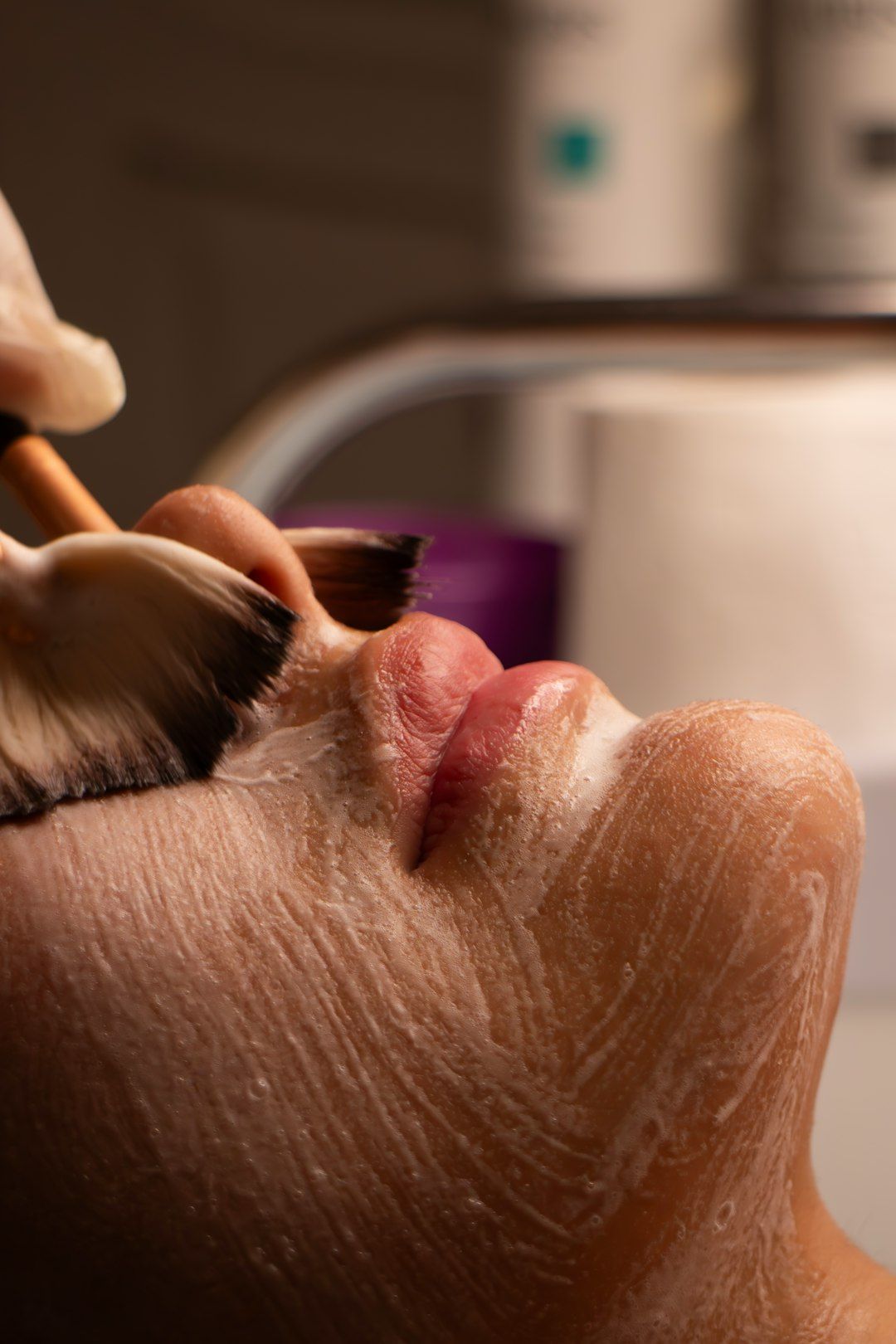 Tratamento de estética facial na RAI Espinho